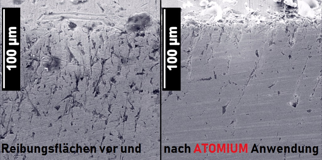 ATOMIUM Doppelpack. Set für Erst und Zweitanwendung